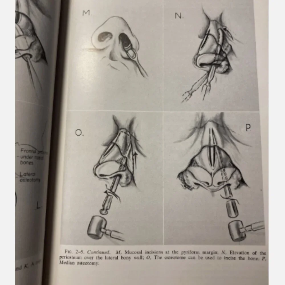 Diseases Of The Nose Throat And Ear 11th Ed John Jacob Ballenger